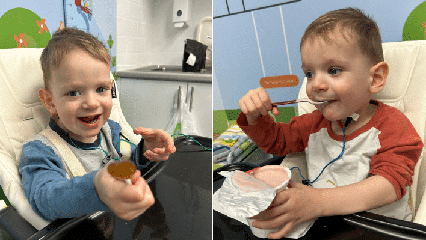 Two year old Harvey sitting in a highchair with the VitalStim device attached to his outer neck, holding a lollypop and smiling, next to an image of him sitting in a highchair holding a tub of yoghurt with a spoon in his mouth.