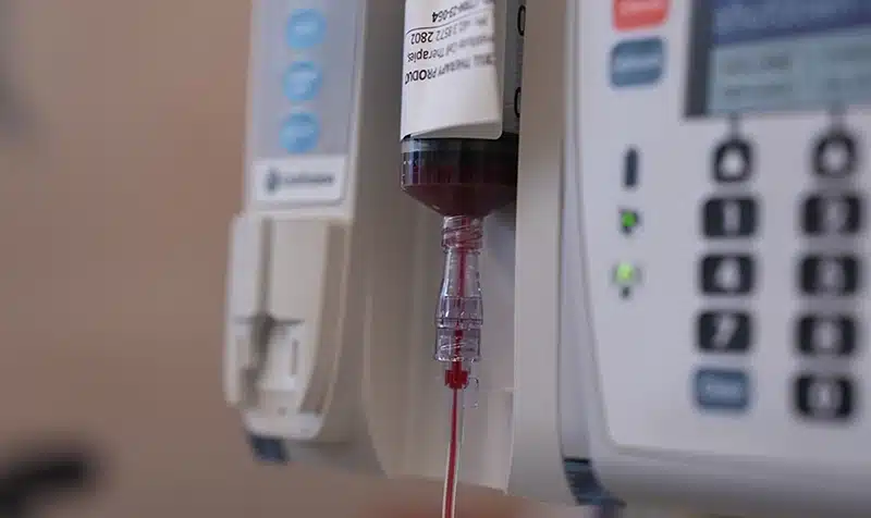 A close up of Zara's umbilical cord blood vile during the infusion