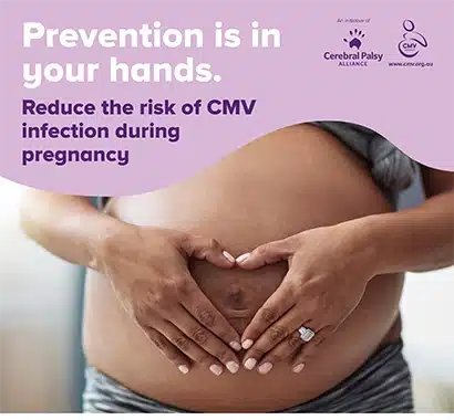 Prevention is in your hands cmv awareness poster showing a pregnant tummy with the woman making a heart shape with her hands