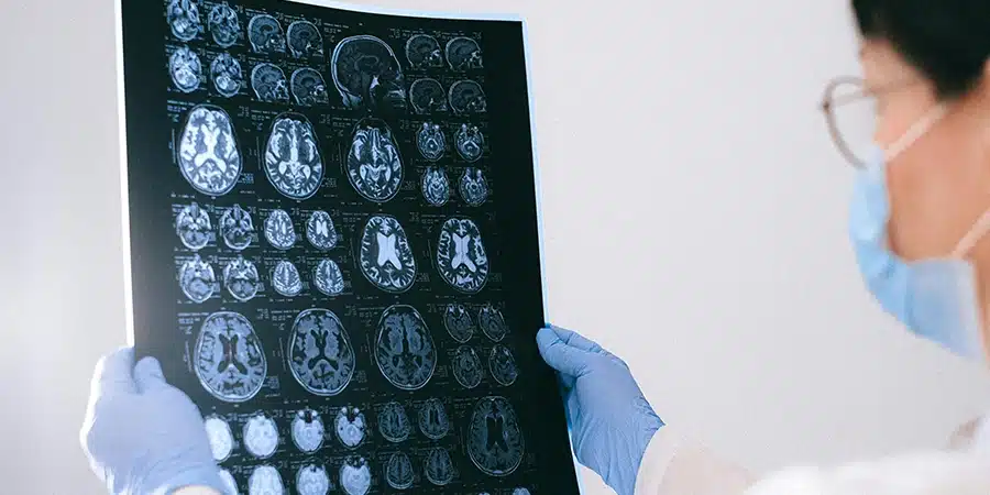 A researcher looking at scans of a human brain